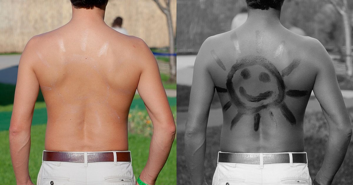 A man's back shown in normal light and under UV light, revealing where sunscreen was missed